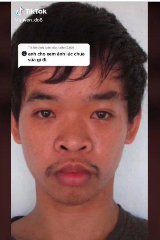 醜男 越南26 歲男子杜文奎（Đỗ Quyền），因為自覺生得醜，令求職屢次失敗