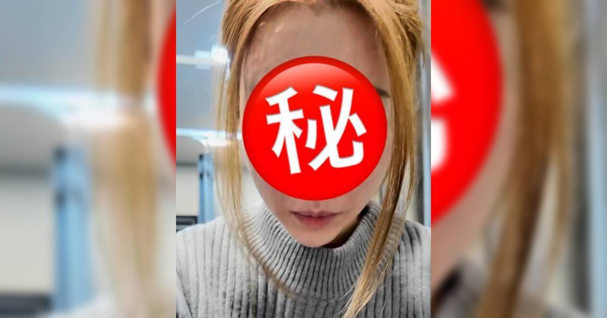 34歲陳婉衡公開赴韓醫美過程 針後狀態極震驚嚇親網民