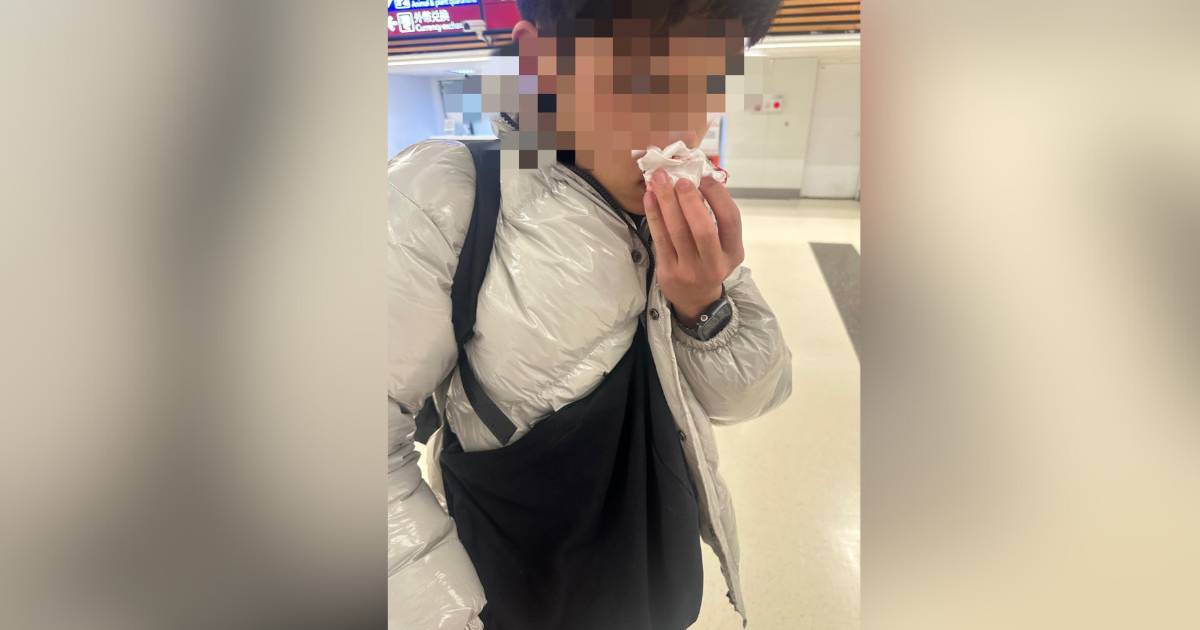 搭飛機眼睛痛到要爆　男生一落機秒流鼻血　7招減輕氣壓痛:上機即瞓超錯