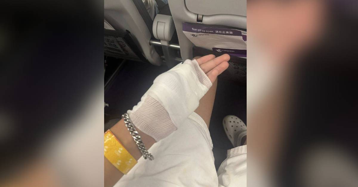 搭香港快運遇前座小童跳不停　港男杯麵滾水倒瀉被燙傷　仲被對方全家辱罵