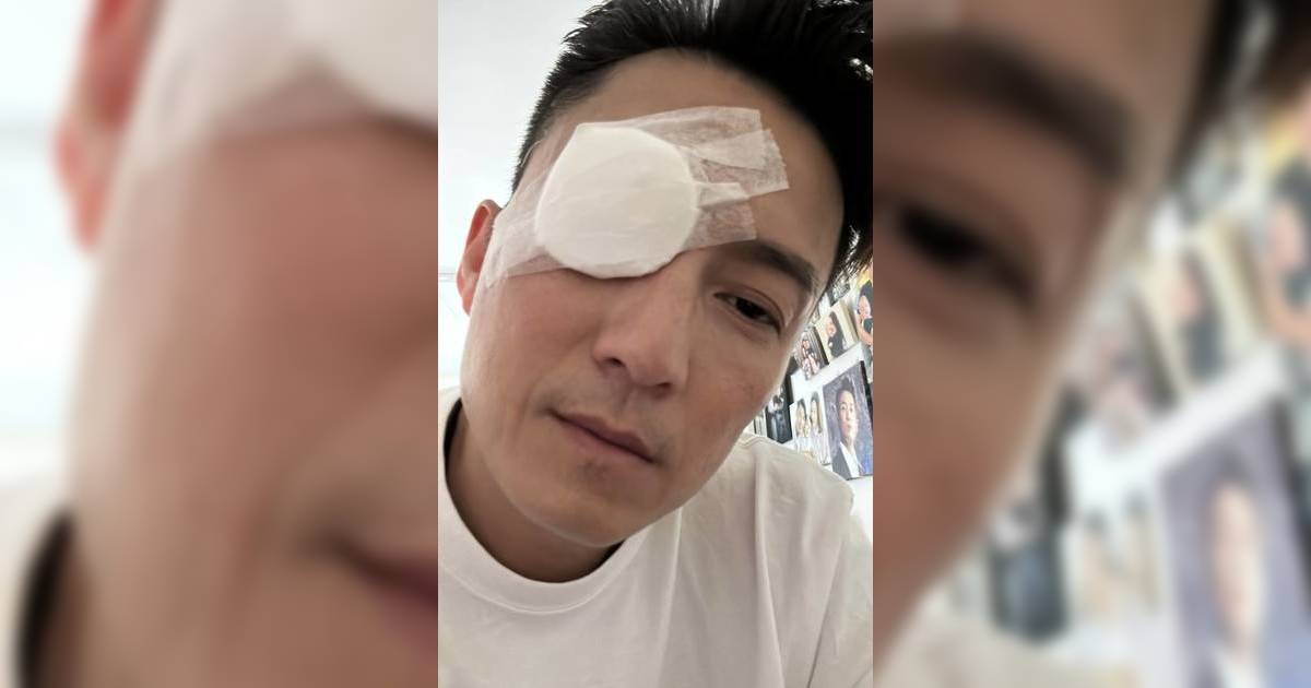 48歲陳山聰驚爆曬眼貼紗布術後照 報平安po網民竟指：你都有今日