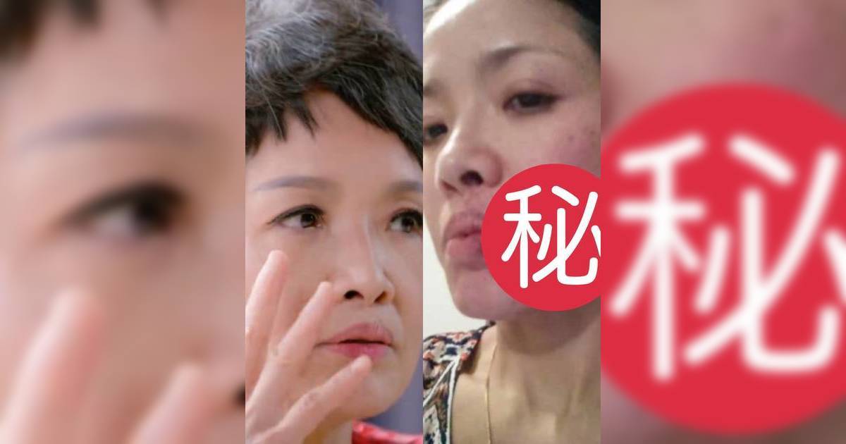 61歲寶珮如曝拍戲被真打傷痕照 半邊臉傷到觸目驚心 出手者竟是金像獎女星