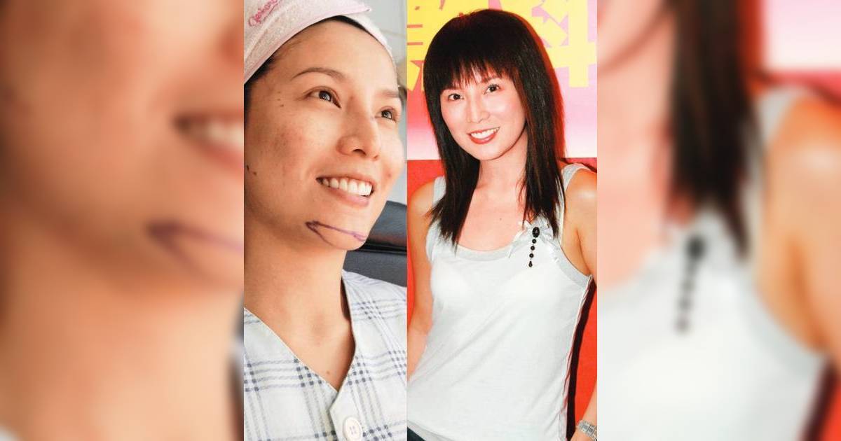 吳文忻離世｜當年收百萬酬勞整容背後全因一句話 成為香港首個公開「人工美女」