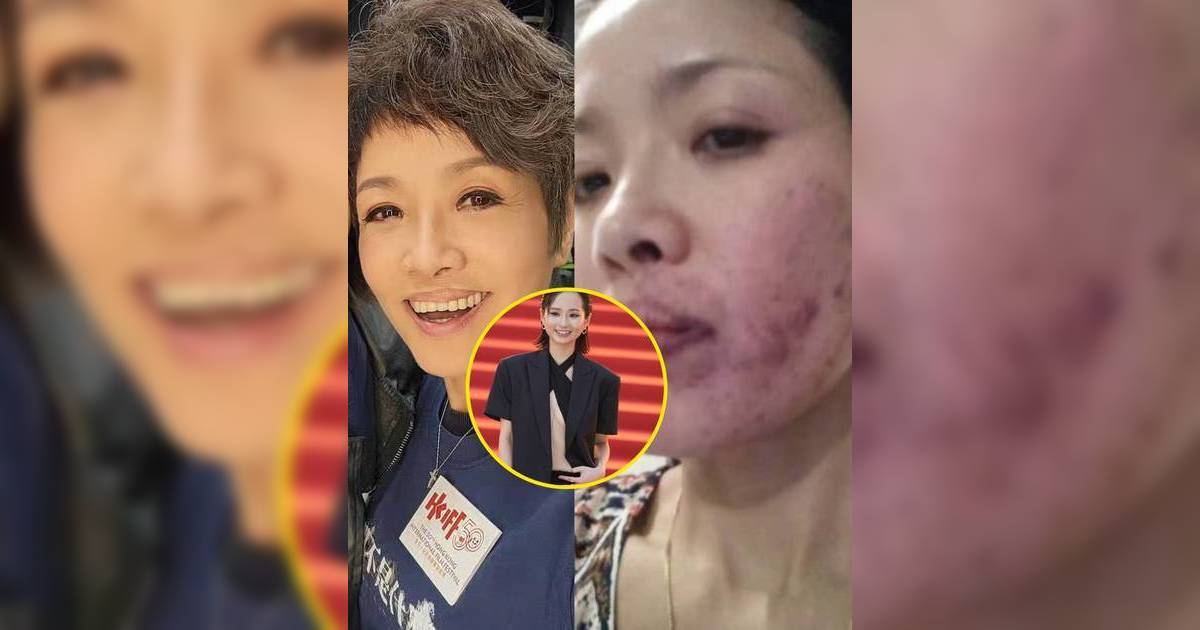 被金像獎女星梁雍婷「掌摑至毀容」驚嚇照瘋傳 寶珮如深夜首發聲揭真相