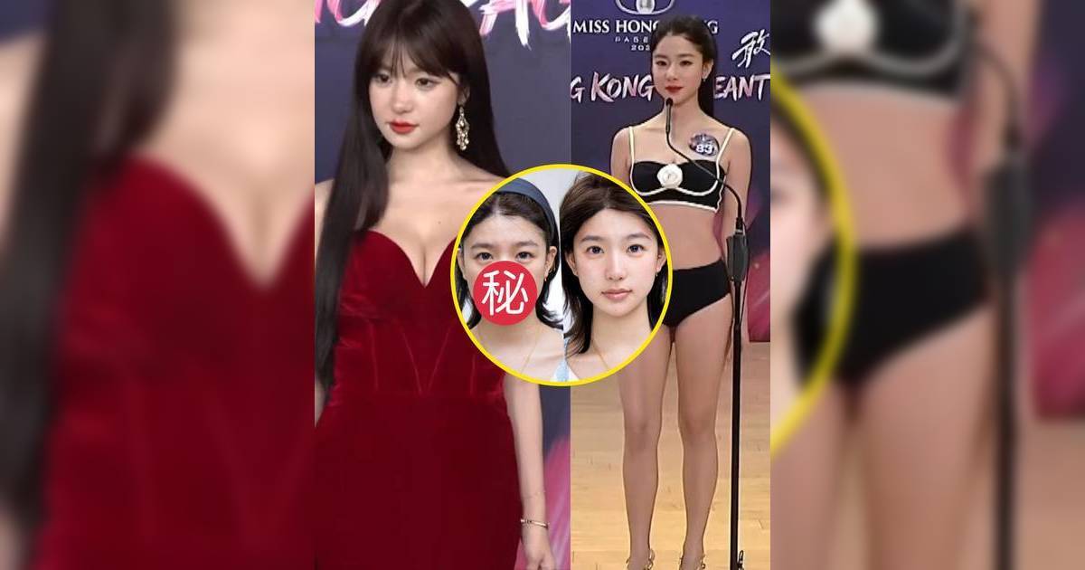 香港小姐2026｜大熱「翻版古佩玲」溫思婷被質疑整容 醫美對比圖隨即流出