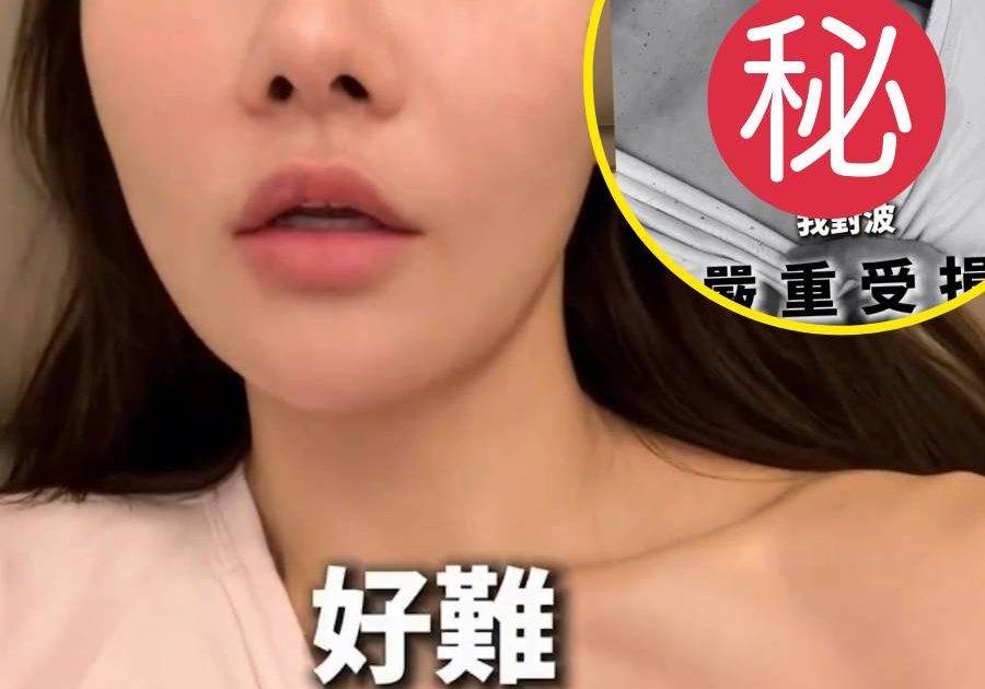 「最強小三」五索驚爆胸部嚴重受傷！崩潰痛喊「我對波係最值錢」竟因1件事